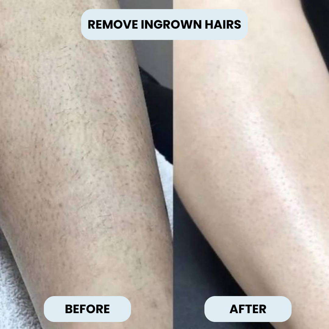 Solys™ SmoothShave Razor
