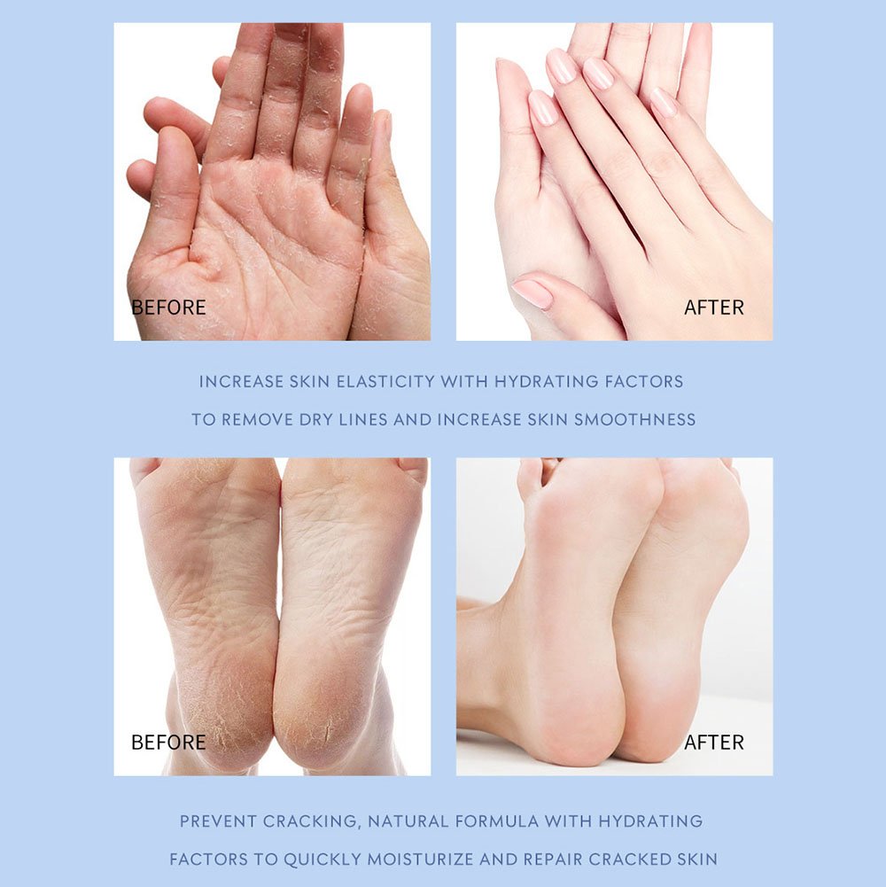 🧴Smooth Steps Foot Therapy 👣 - Anti-Crack & Deep Hydration🦶