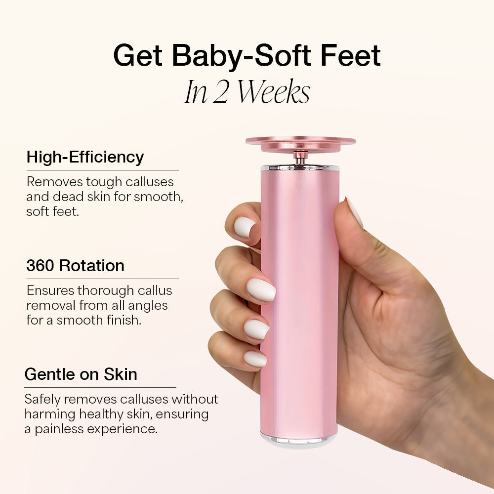 Czucon™ Electric Foot Callus Remover