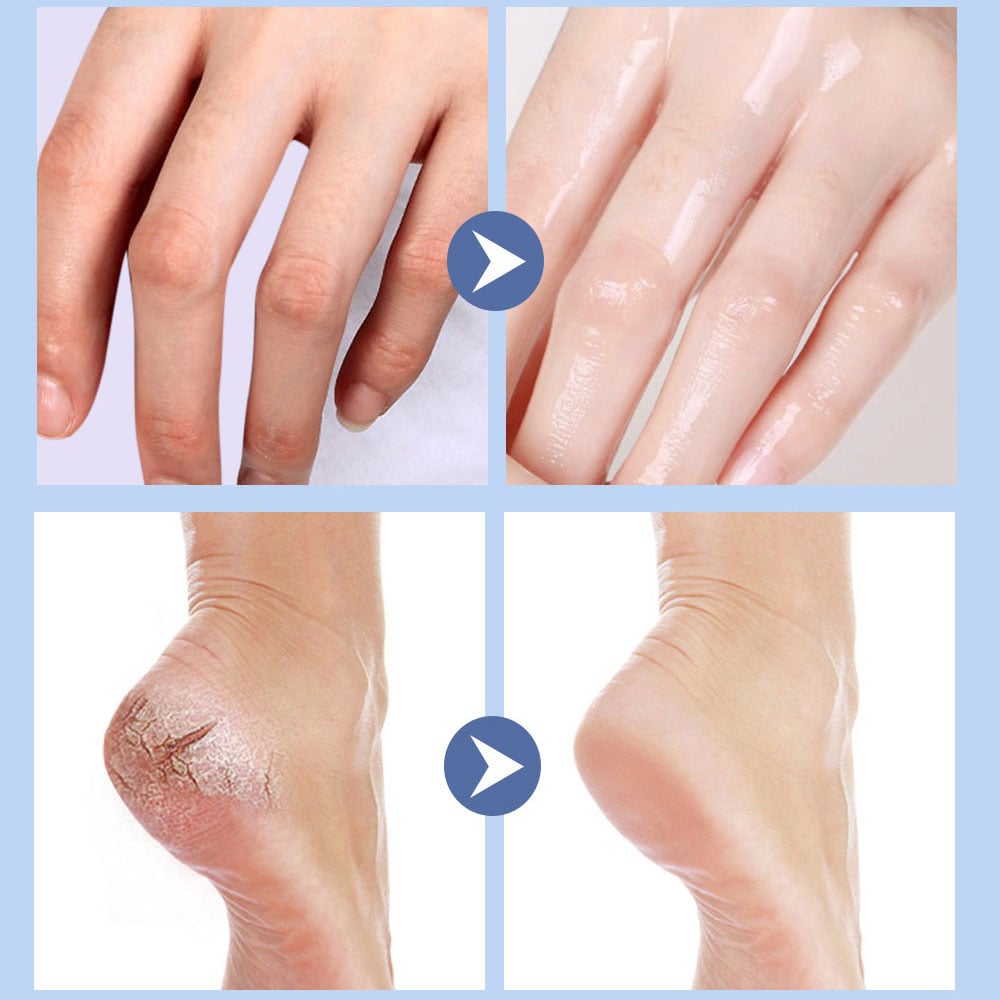 🧴Smooth Steps Foot Therapy 👣 - Anti-Crack & Deep Hydration🦶
